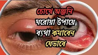 Eye pain | How to reduce pain with home remedies |