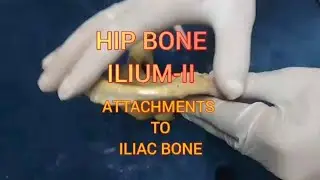 ANATOMY OF HIP BONE- ILIUM-II- ATTACHMENTS TO ILIUM