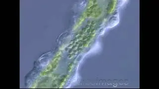 Green Hydra with algae