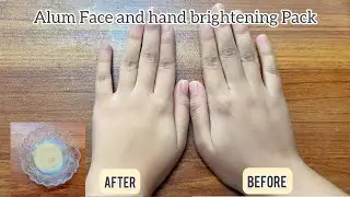 Alum Face & Hands brightening pack|| Instant Results✅