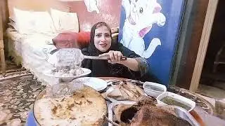 حبايبي تعالوا نتغدى وشوفوا قبل العمليه عيني كانت عامله ازاي🥲♥️