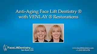 Anti Aging Face Lift Dentistry&reg;