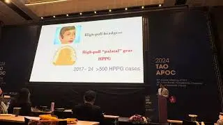 Lecture in 2024 APOC: HPPG technique for treating gummy smile and hyperdivergent faces