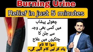 Burning Urine? 100% Treatment with Homeopathic Medicine | Dr. Raja Ghulam Mustafa . #UTIHomeopathic