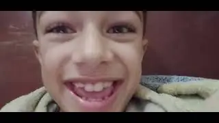 The story of how a got a pinkeye uckk