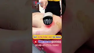 Bioelectric machine combined with electrothermia cupping in 1 therapy handle #dds #thermotherapy ...