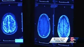 Blood pressure's factor in dementia