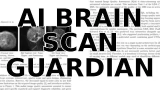 This AI is a Guardian for Children's Brain Scans