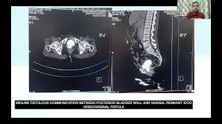 CTBUZZ2023- Papers: Dr Nitin Sharma: Value of CT Urography in Hematuria