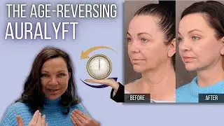 AuraLyft: The Truth Behind the Transformation | Dr. Ben Talei | Beverly Hills Center