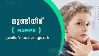 മുണ്ടിനീര് ശ്രദ്ധിയ്ക്കേണ്ട കാര്യങ്ങൾ/mumps /symptom/treatment/precuation