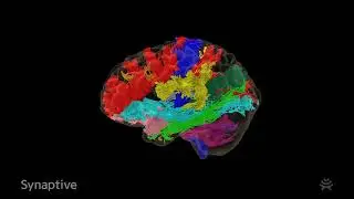 Modus Plan&trade; provides easy access to tractography