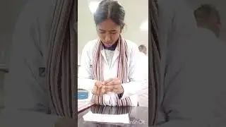 peripheral blood smear|mbbs edition|#viral #mbbsstudent #mbbs #mbbsmotivation