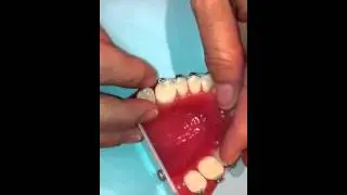 Murphyorthodontic