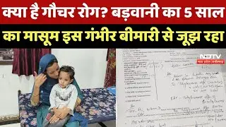 Barwani News : क्या है Gaucher Disease? बड़वानी का 5 साल का Bilal इस गंभीर बीमारी से जूझ रहा | MP
