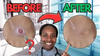 Debridement Explained: Why We Don&rsquo;t Just Cover Wounds