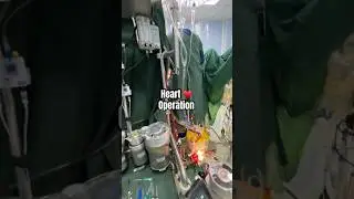 &hearts;️ Heart Operation ? Kaise Hoti hai Cardiac Surgery ? Dil ka operation ? Cardiac Bypass