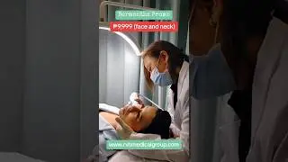 Thermage