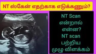 NT Scan during pregnancy in tamil / 3rd month scan during pregnancy in tamil / Nuchal scan / NT scan