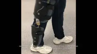Walking with a natural gait for the first time in five years