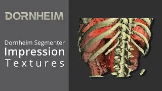 Dornheim Segmenter Impression - Textures