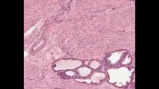 Shotgun Histology Prostate
