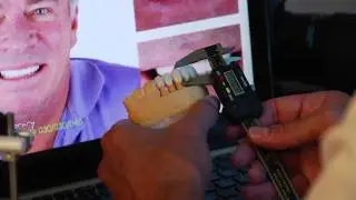 Digital Smile Design DSD Master Dr. Jason Olitsky