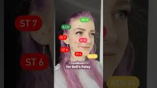 Acupuncture Points for Bell&rsquo;s Palsy 🥴