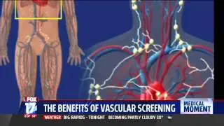 Benefits of vascular screening