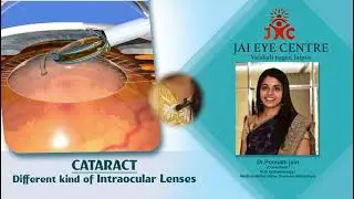 Understanding Different Types of Intraocular Lenses (IOLs) 👁️✨