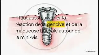 Petites Vis Grands Sourires
