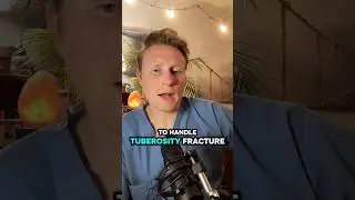 Tuberosity Fracture - Clip from TikTok LIVE #53 Podcast #oralsurgery #dentist #doctorgallagher