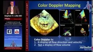 Echo/Doppler (Stephen H. Little, MD)  Sunday, August 21, 2016