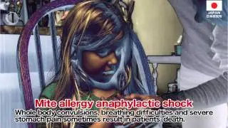 Dust Mite Control