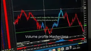 Volume Profile Masterclass | Live Trades + Yap