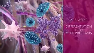 Discover the Science of Youthful Transformation with Sculptra at Real You Clinic