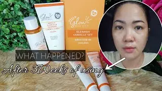 Hello glow Blemish miracle Set (3weeks Review)