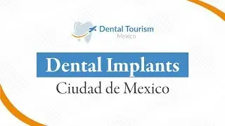 Dental Implants - Ciudad de Mexico
