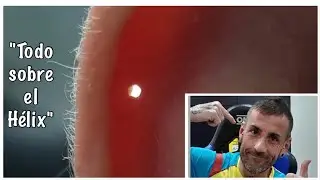 TODO SOBRE EL HÉLIX Y LAS PERFORACIONES EN EL CARTÍLAGO! 😉😋💉