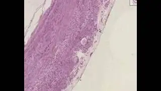 Shotgun Histology Appendix