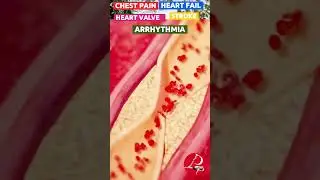 Yoga For Heart | Heart Attack Yoga | Yoga For Heart Disease | Heart Problems Pawan Yoga |