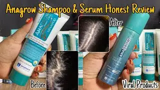 Anagrow Shampoo and Serum Honest Review | jenpharm  Anagrow Hair Growth Bundle | worth it? 
