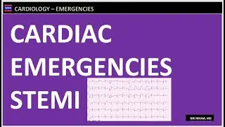 Cardiac Emergencies STEMI Management by Nik Nikam MD