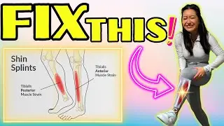 Fix Shin Splints Permanently | Step-By-Step Guide To Relieve Shin Pain Fast (MTSS Treatment)