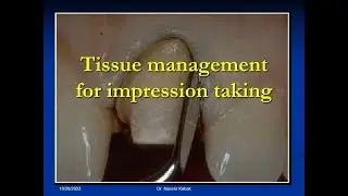 تبعيد اللثة لأخذ الطبعة النهائية في التعويضات الثابتة  Tissue management for final impressions