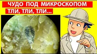 Где Живут Тополевые Галловые Тли? Спиралевые Тли Pemphigus spyrothecae Под Микроскопом. Удивительно!