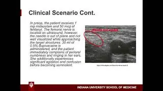 A Case of Local Anesthetic Systemic Toxicity (LAST) by Adam Warrick, MD Candidate Class of 2022