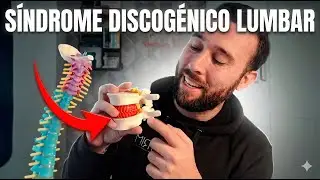 S&Iacute;NDROME DISCOG&Eacute;NICO LUMBAR | El dolor neurop&aacute;tico detr&aacute;s del deterioro discal😱