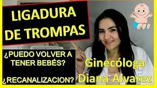 LIGADURA DE TROMPAS,  ¿PUEDO VOLVER A EMBARAZARME?, POR GINECOLOGA DIANA ALVAREZ