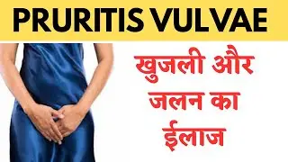Pruritis vulvae । Itching in private area 